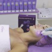 Процедура мультипептидного омоложения кожи с использованием фотонного мезороллера (высота игл 0,5 мм) - Beauty Business - Выбор профессионалов!