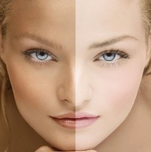 Программа для осветления гиперпигментаций – сухая кожа - Beauty Business - Выбор профессионалов!